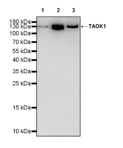 TAOK1 Recombinant Rabbit mAb (S-3673-80)