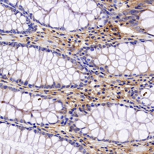 PKA C-α Recombinant Rabbit mAb (S-2564-5)