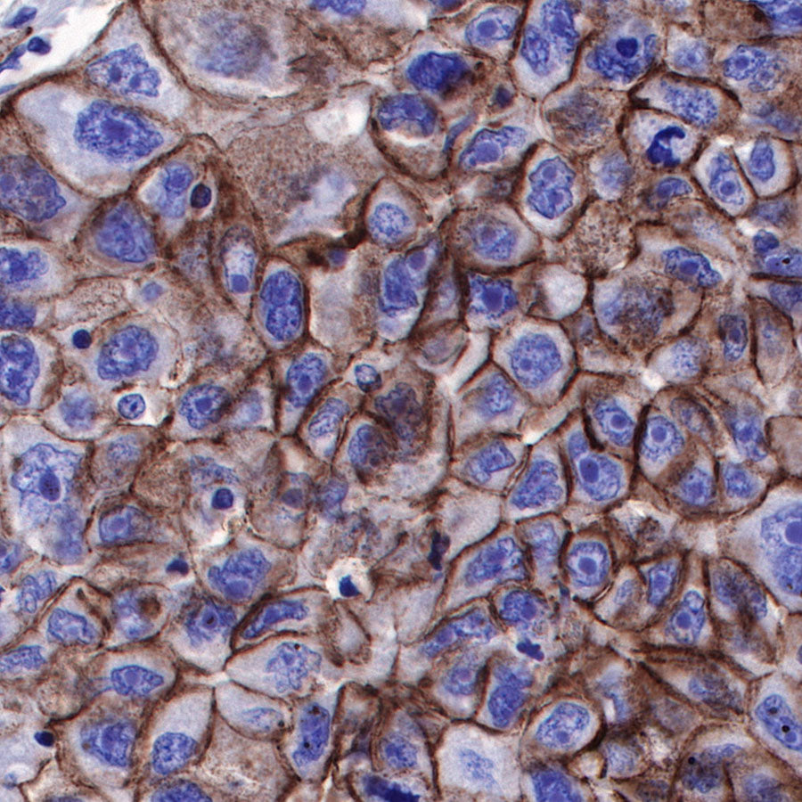 Nectin-4 Recombinant Rabbit mAb (SDT-277-229)
