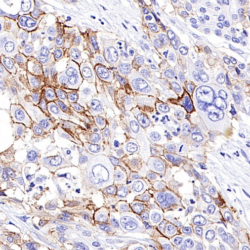 CD44v6 Mouse mAb (S-945-76)