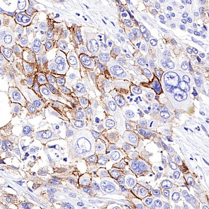 CD44v6 Mouse mAb (S-945-76)