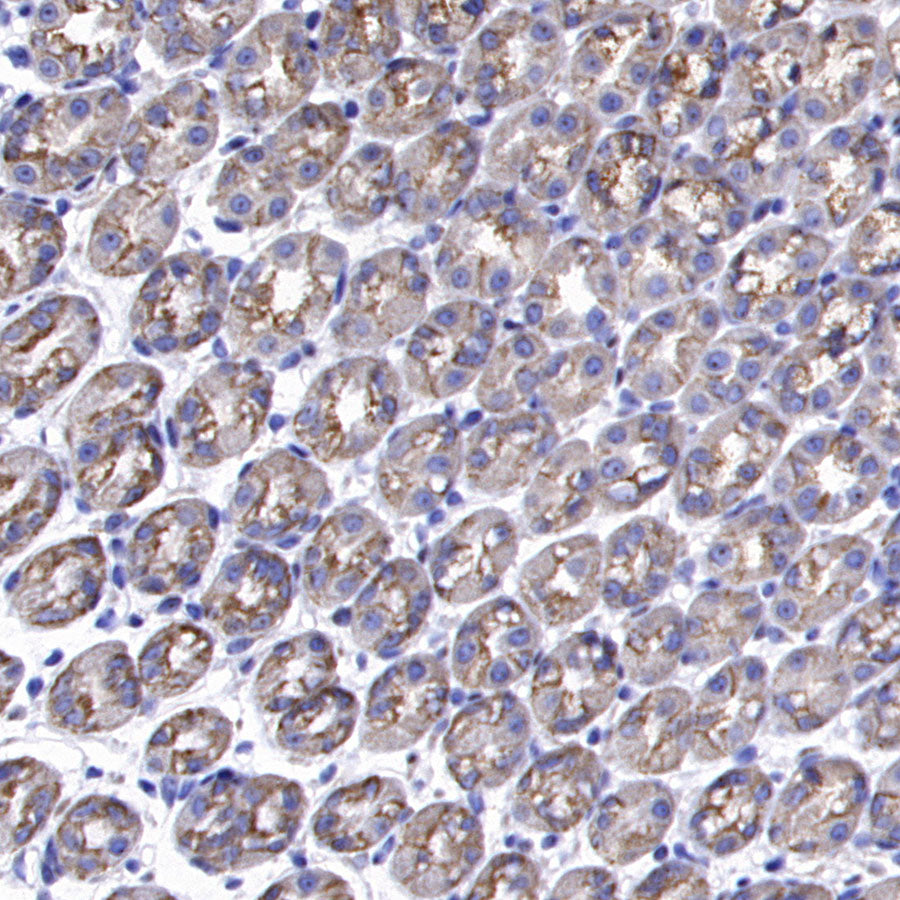 SCTR Recombinant Rabbit mAb (S-3949-52)