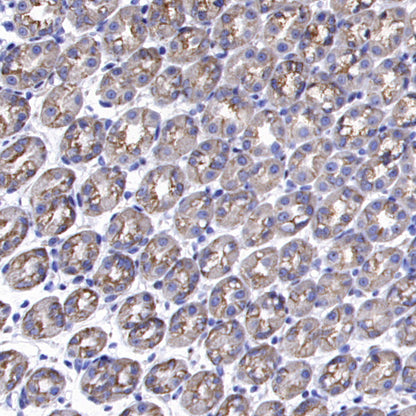 SCTR Recombinant Rabbit mAb (S-3949-52)