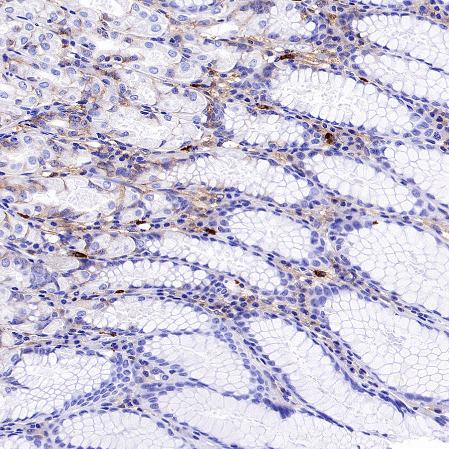 PTK7 Recombinant Rabbit mAb (SDT-2432-156)