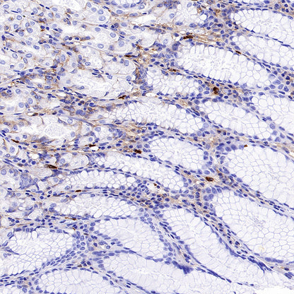 PTK7 Recombinant Rabbit mAb (SDT-2432-156)