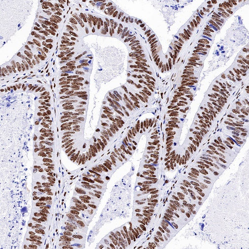 KAP-1 Recombinant Rabbit mAb (S-986-5)