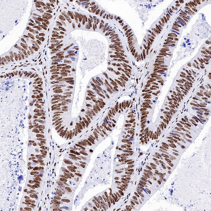 KAP-1 Recombinant Rabbit mAb (S-986-5)