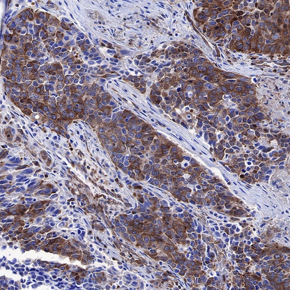 NF-κB p65 Recombinant Rabbit mAb (S-475-56)