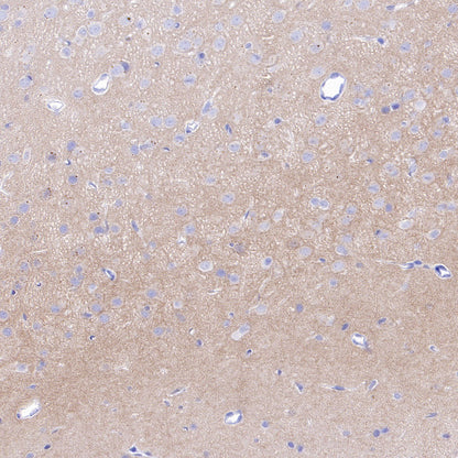 CaV2.3 (CACNA1E) Recombinant Rabbit mAb (S-3244-59)