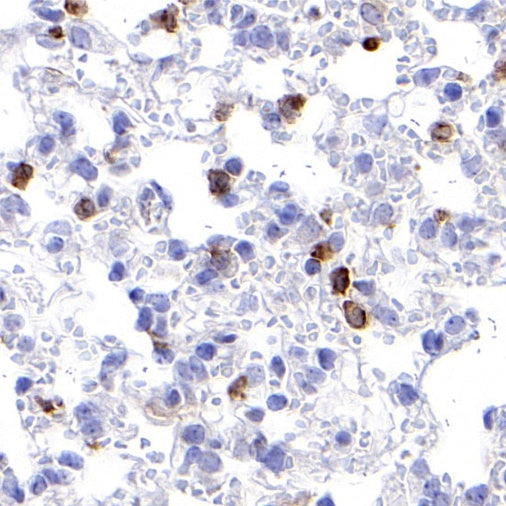 CSF-1R Recombinant Rabbit mAb (S-467-26)