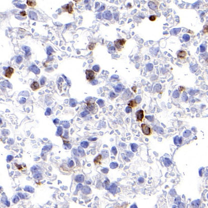CSF-1R Recombinant Rabbit mAb (S-467-26)