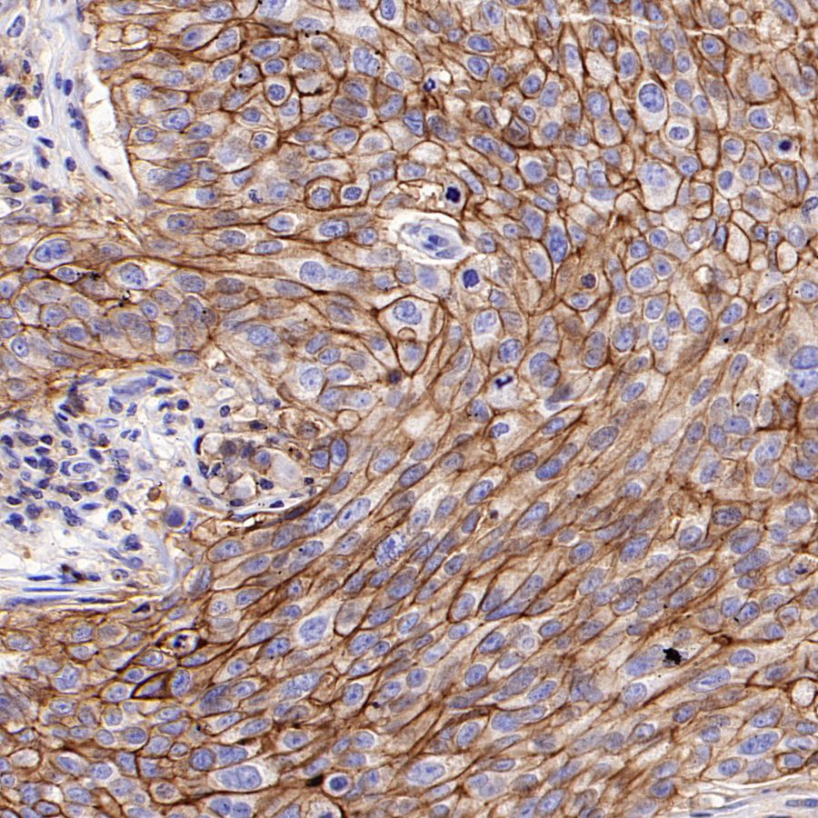 CD98/SLC3A2 Recombinant Rabbit mAb (SDT-2038-19)