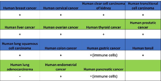 LOX Recombinant Rabbit mAb (S-1647-49)