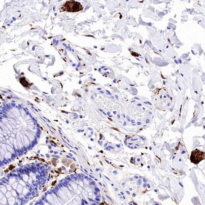 UCHL1 Recombinant Rabbit mAb (S-1765-38)
