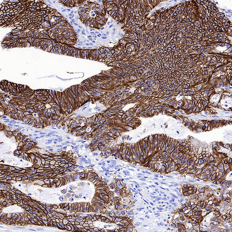 CDH17 Recombinant Rabbit mAb (SDT-3276-46)