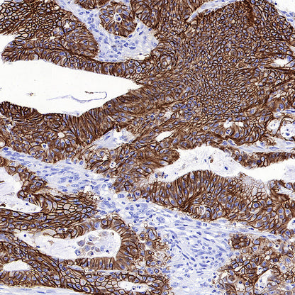 CDH17 Recombinant Rabbit mAb (SDT-3276-46)