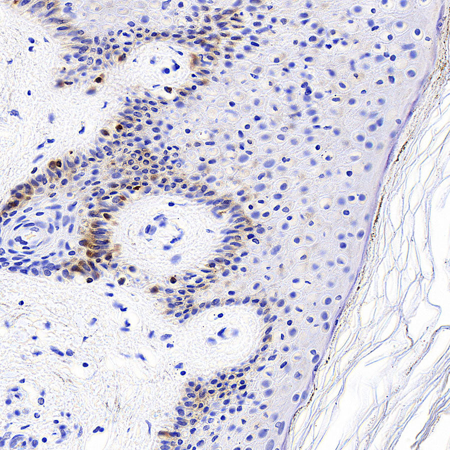 Tyrosinase Recombinant Rabbit mAb (S-5955)