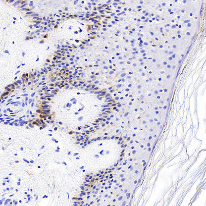 Tyrosinase Recombinant Rabbit mAb (S-5955)