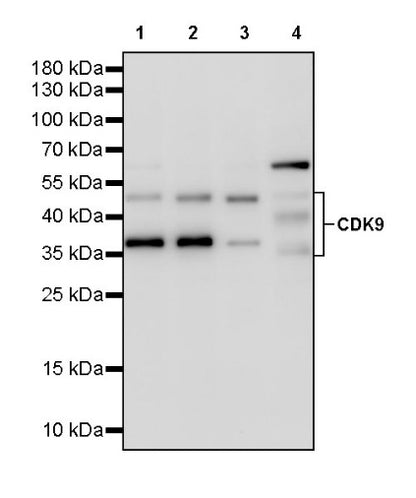 CDK9 Recombinant Rabbit mAb (S-2661-10)