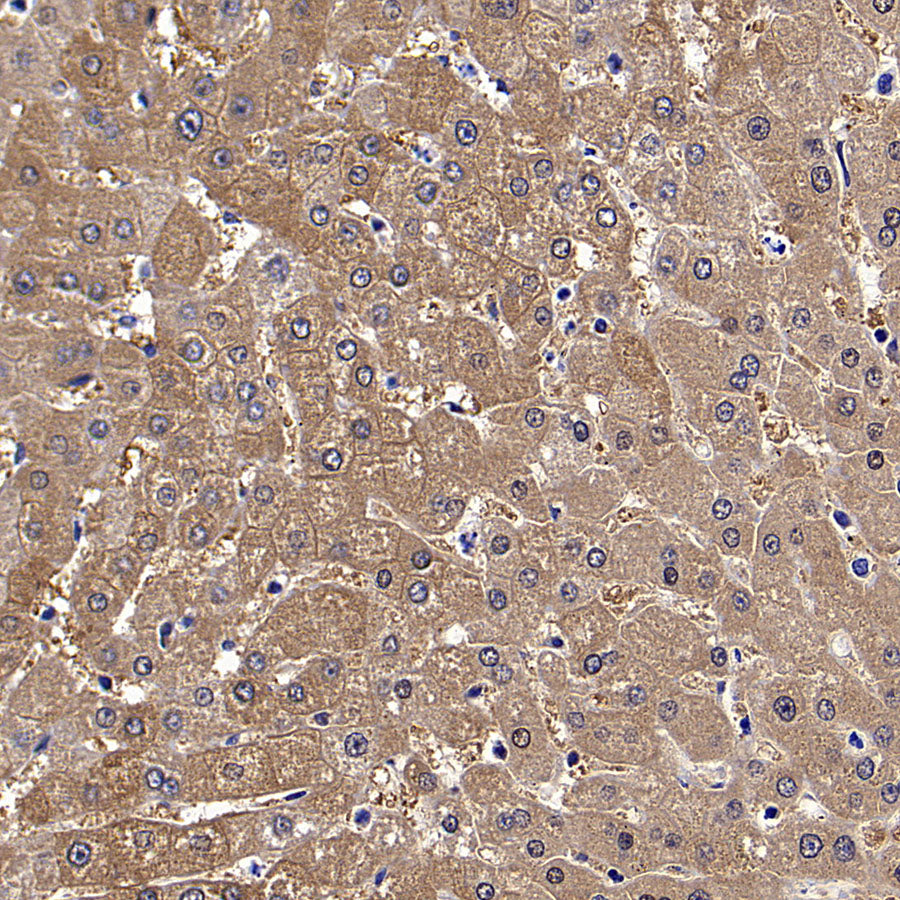 Aass Recombinant Rabbit mAb (S-4170-22)