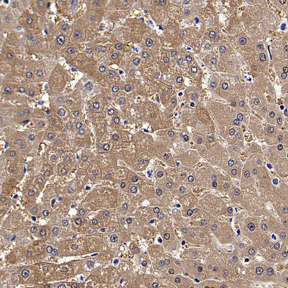 Aass Recombinant Rabbit mAb (S-4170-22)
