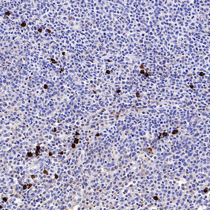 Human IgA1 Rabbit Polyclonal Antibody