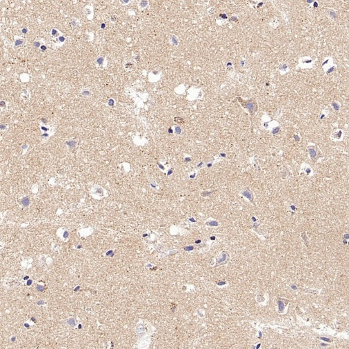 FDX1 Recombinant Rabbit mAb (S-3587-58)