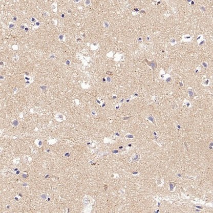 FDX1 Recombinant Rabbit mAb (S-3587-58)