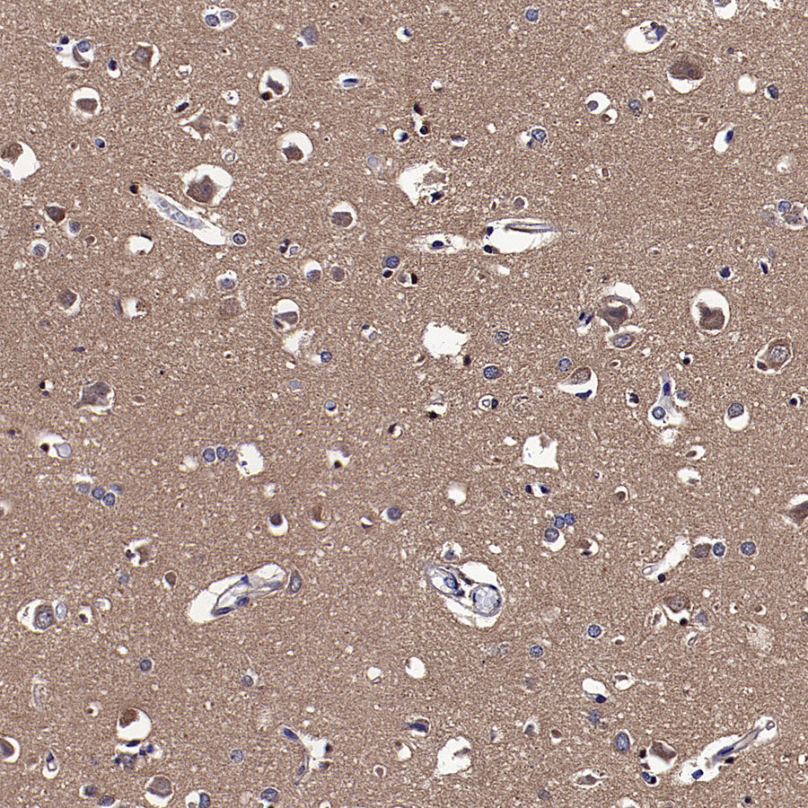 pan PDE4 Recombinant Rabbit mAb (S-5034)