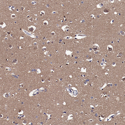 pan PDE4 Recombinant Rabbit mAb (S-5034)