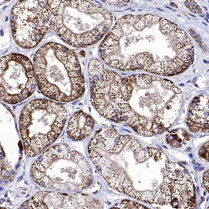 Fumarate hydratase Rabbit Polyclonal Antibody