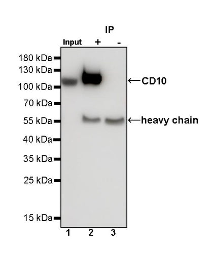 CD10 Recombinant Rabbit mAb (SDT-006-77)