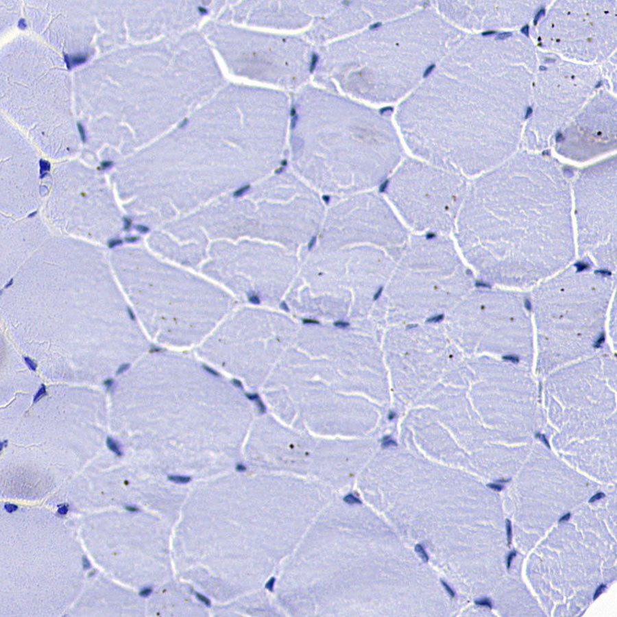 MYBPC3 Recombinant Rabbit mAb (S-5476)