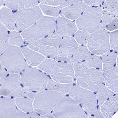 MYBPC3 Recombinant Rabbit mAb (S-5476)