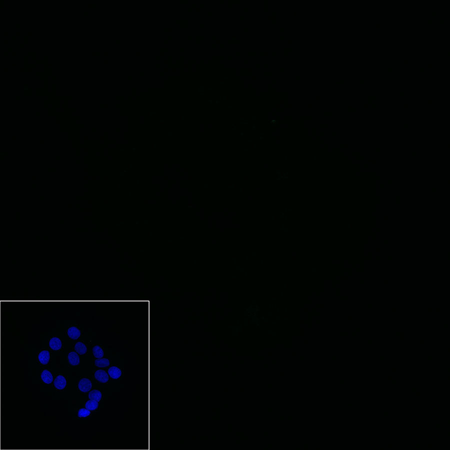 Claudin-1 Recombinant Rabbit mAb,PBS Only (SDT-R024)