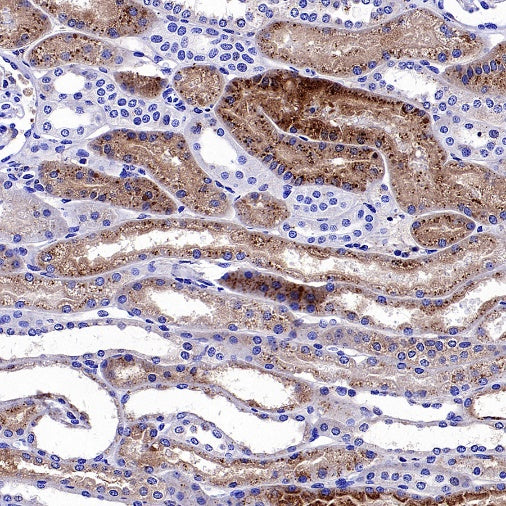 AACT Recombinant Rabbit mAb (S-897-109)