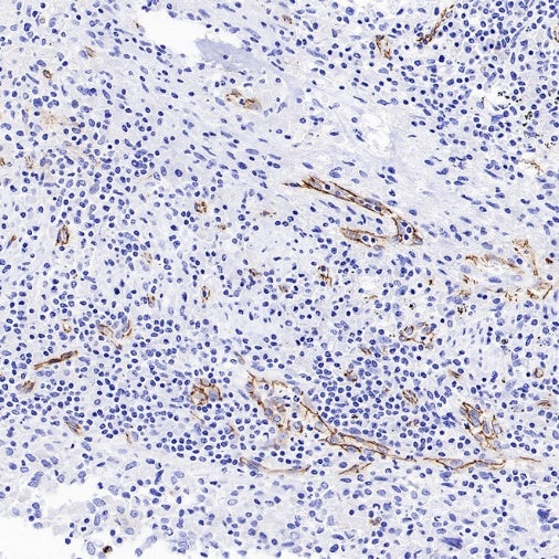 VE Cadherin Recombinant Rabbit mAb (S-3312-118)