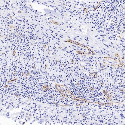 VE Cadherin Recombinant Rabbit mAb (S-3312-118)