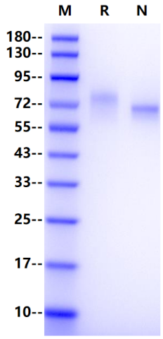 Thrombomodulin His Tag Protein, Human