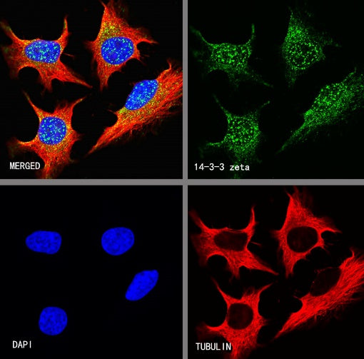 14-3-3 zeta Recombinant Rabbit mAb (S-1092-31)