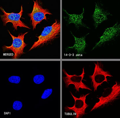 14-3-3 zeta Recombinant Rabbit mAb (S-1092-31)
