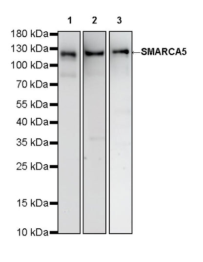 SMARCA5 Recombinant Rabbit mAb (S-4446-48)