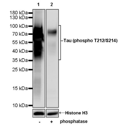 Tau (phospho T212/S214) Recombinant Rabbit mAb (S-1538-74)
