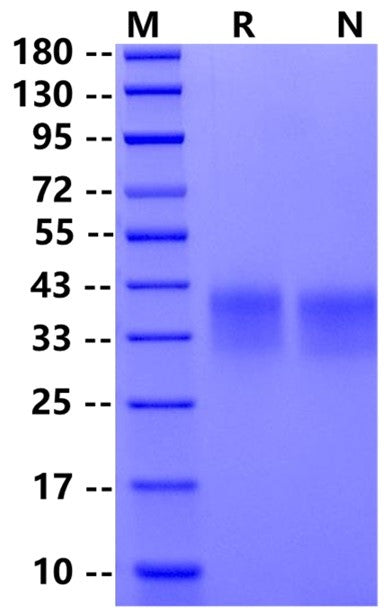 Biotinylated PD-1 Avi&His Tag Protein, Human