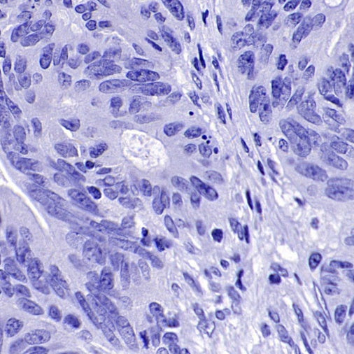 ER alpha Recombinant Rabbit mAb (SDT-2950-36)