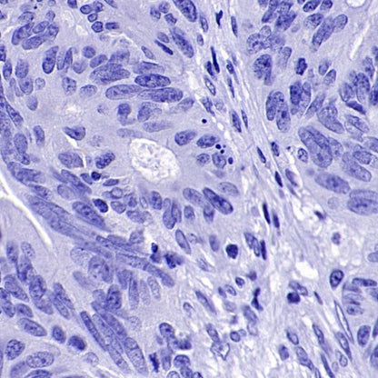 ER alpha Recombinant Rabbit mAb (SDT-2950-36)