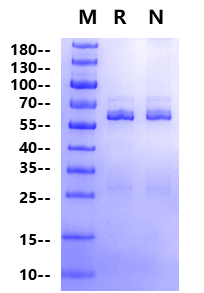 RIPK2 GST Tag Protein, Human