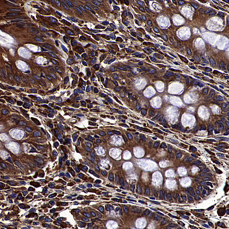 Calreticulin Recombinant Rabbit mAb (S-3920-39)