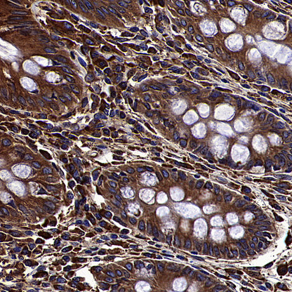 Calreticulin Recombinant Rabbit mAb (S-3920-39)