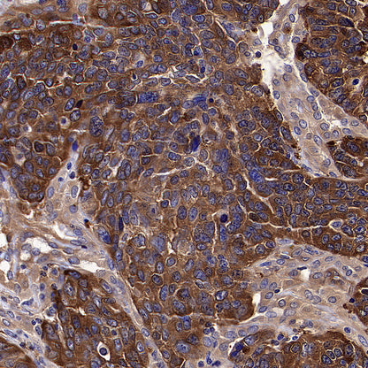 HSP90 alpha/beta Recombinant Mouse mAb (S-5282)